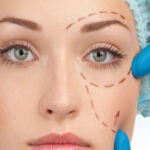 Eyelid Aesthetic Surgery