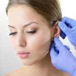 Otoplasty (Prominent Ear Surgery)